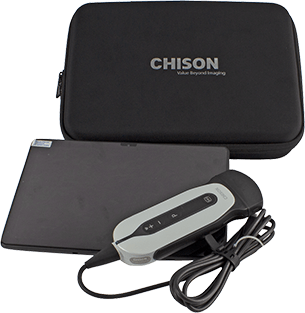 SonoEye P5 Abdomen, ultra- portables Ultraschallsystem