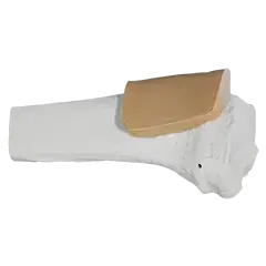 Arrow Trainingsknochen Erwachsene Proximal Tibia für EZ-IO